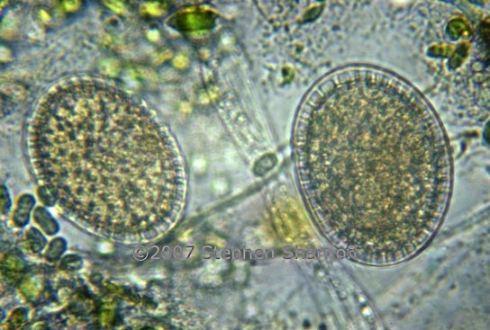 algal cells 3 graphic